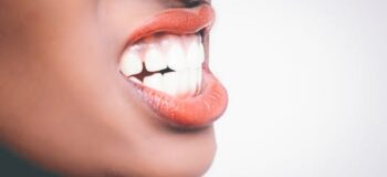 What Is the Best Way to Get the Perfect Smile?